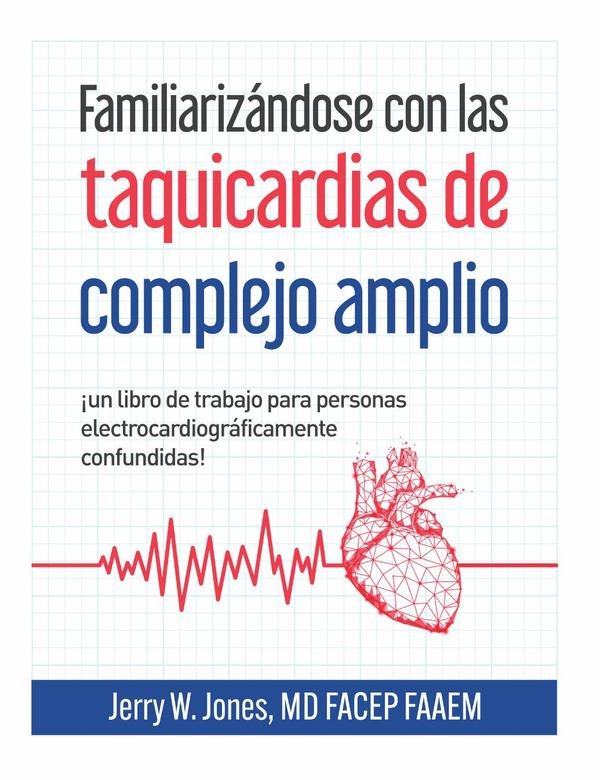 Familiarizándose con las taquicardias de complejo amplio