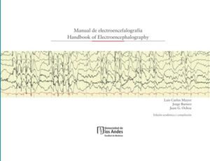 Manual de electroencefalografía