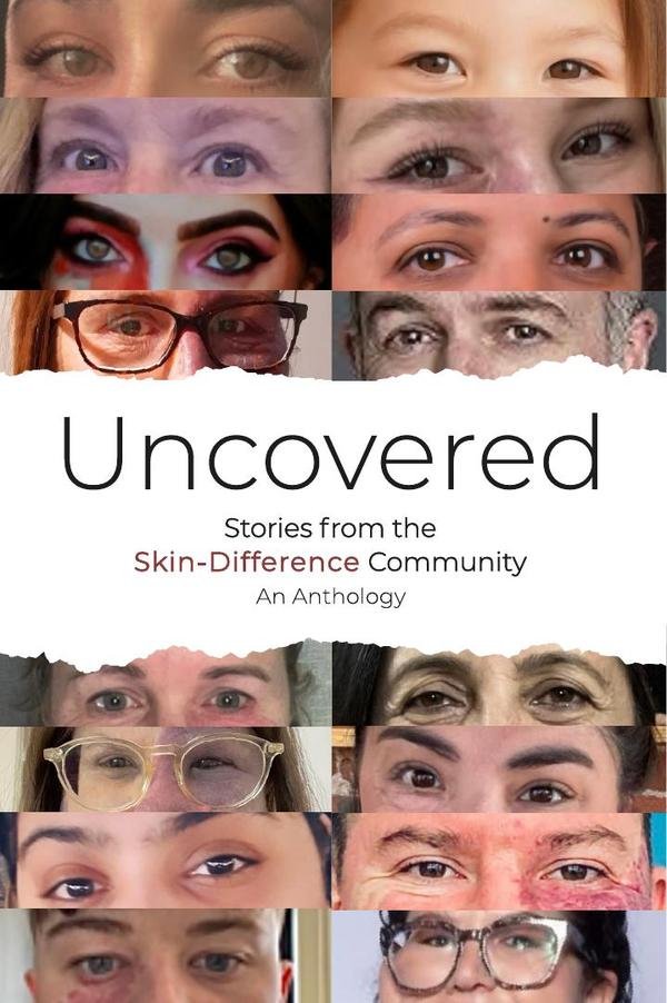 Uncovered